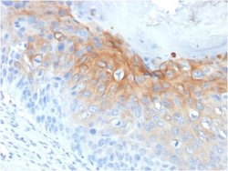 Cytokeratin 1 Antibody (KRT1/1840) - Azide and BSA Free, Novus Biologicals